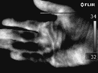 image thermique noir et blanc de la paume d'une main