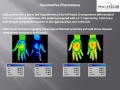 120px-Circulation-Thermography-Changes.jpg