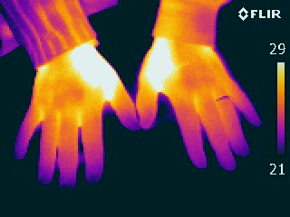thermogramme de deux mains