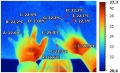 120px-Syndrome raynaud thermographie.jpg