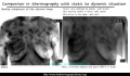120px-Cancer-thermography-dynamic.jpg