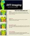 100px-Breast-cancer-thermography.jpg