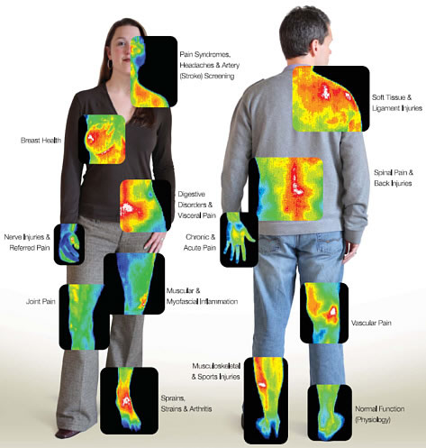 Fusion de thermographies des affections détectables en imagerie infrarouge, copyright Wellness Institute