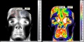 120px-Figure thermography comparaison human.jpg