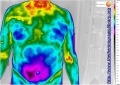 120px-Liver-followup-thermography-testo-890.jpg
