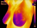 120px-Breast thermography.jpg
