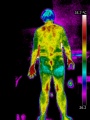 90px-Homme-dos-thermographie.jpg