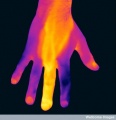 116px-Infection-doigt-thermographie-medicale.jpg