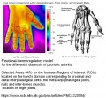 120px-Psoriasis-arthritis-thermographie-infrarouge.jpg