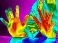 120px-Sclerose-thermographie-ici.jpg