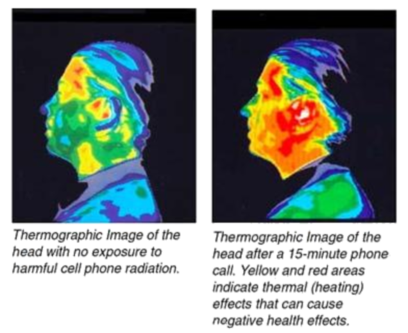 Thermograhie du profil d'une personne ayant utilisé un smartphone contre son oreille pendant 15 minutes. Source: Before It's new