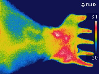 Image thermographique d'un poignet humain