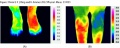 120px-Pied-inflammation-genou-arthrite-thermographie.jpg