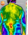 97px-Back-male-thermography-medical.jpg