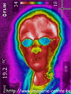 Thermographie du visage d'une fillette, corps humain