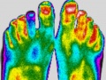 120px-Pieds-fille-thermographie-infrarouge.jpg