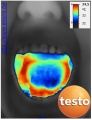 92px-Tong-geneeskunde-thermografie-infrarood.jpg