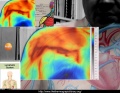 120px-Epaule-anatomie-thermographie.jpg
