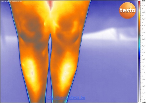 Thermographie d'un genou de femme
