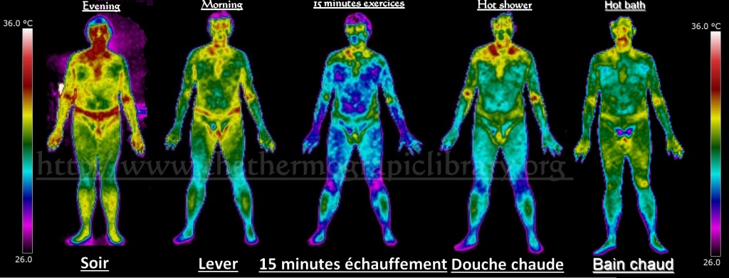 Image en thermographie des variations thermique d'une personne, corps humain complet de face