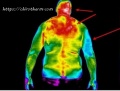 C5-subluxation-thermography.jpg