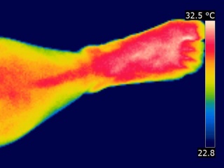 Image thermographique d'une pied et d'une cheville d'un corps humain