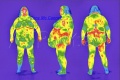 Obesite-thermographie.JPG