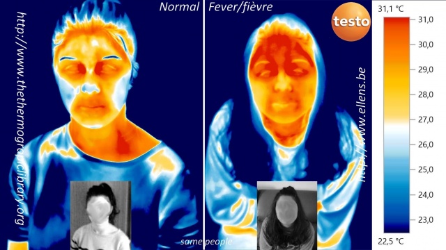 Image thermique comparative d'une même personne en état normal et en état fiévreux
