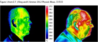 Comparaison de l'évolution technologique sur thermographie de profil d'homme