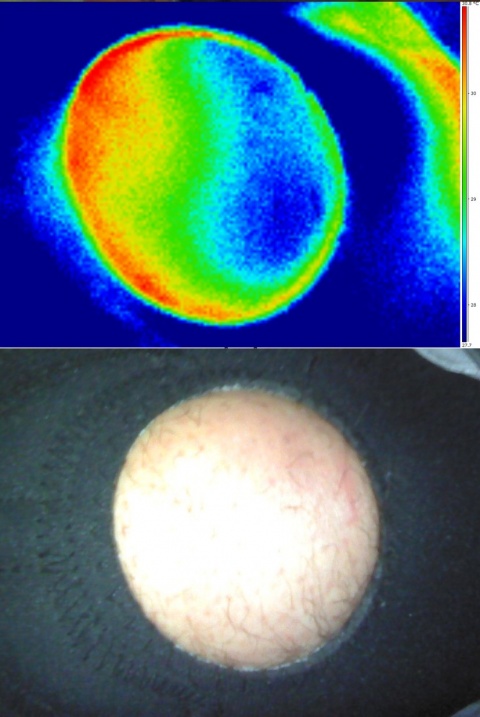 Image double d'une rotule thermographiée sous attelle
